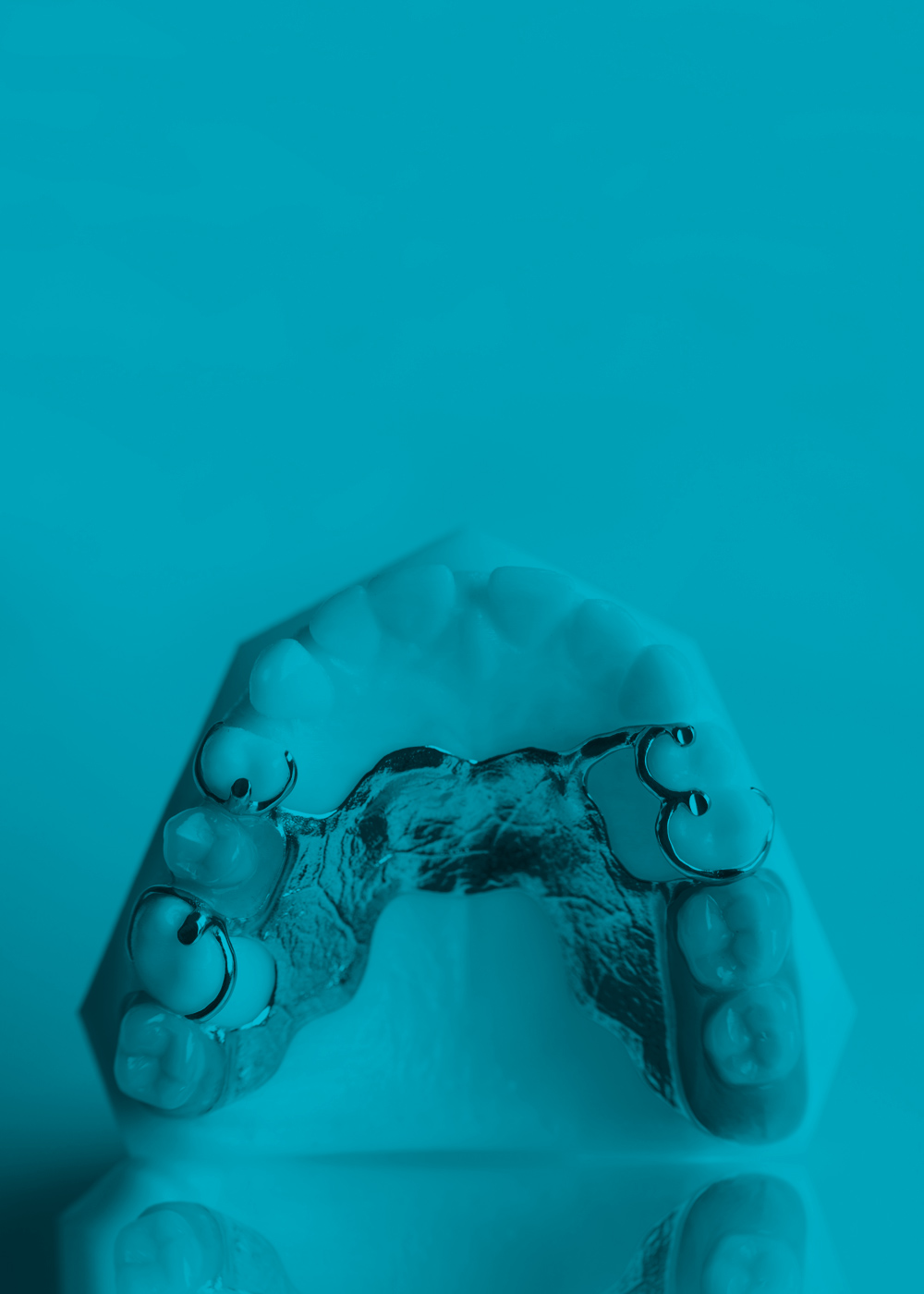 Prótesis parciales removibles blue image