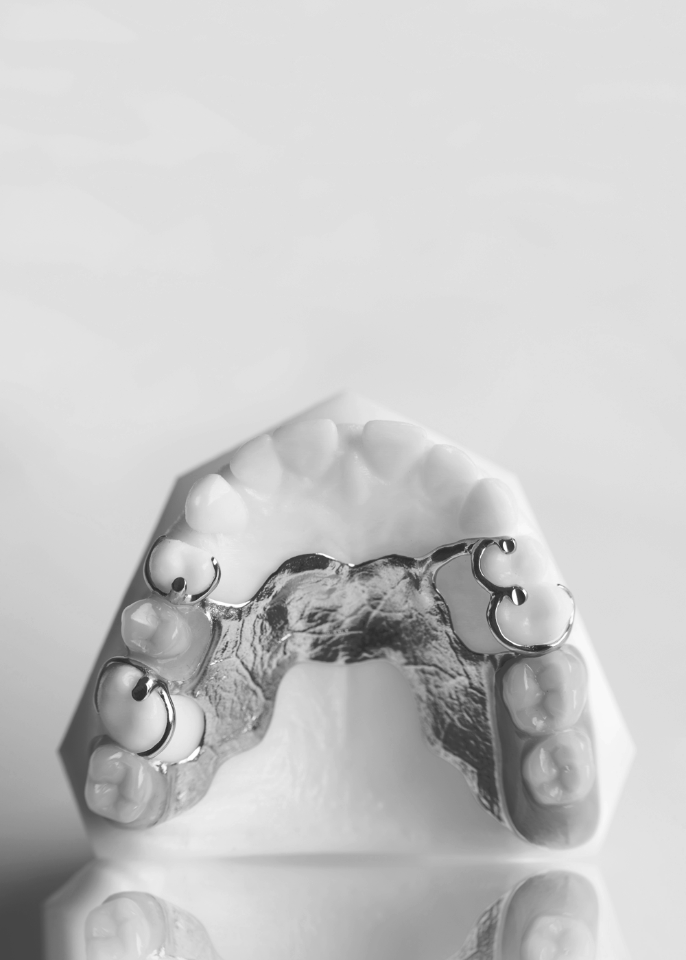 Removable partial dentures