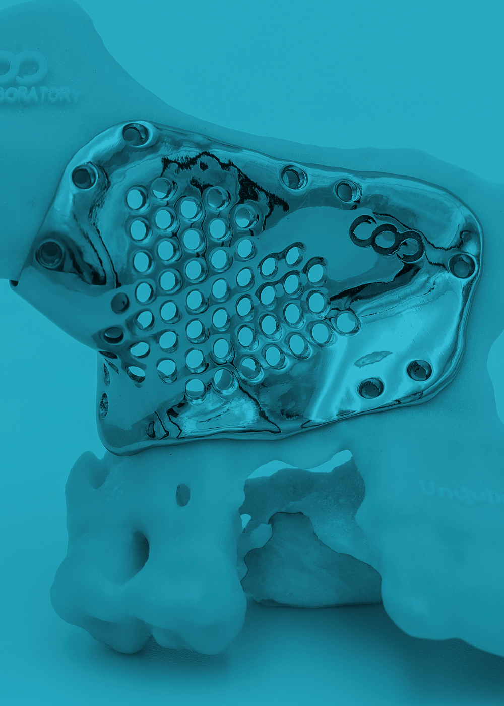 Implantes faciales de titanio blue image